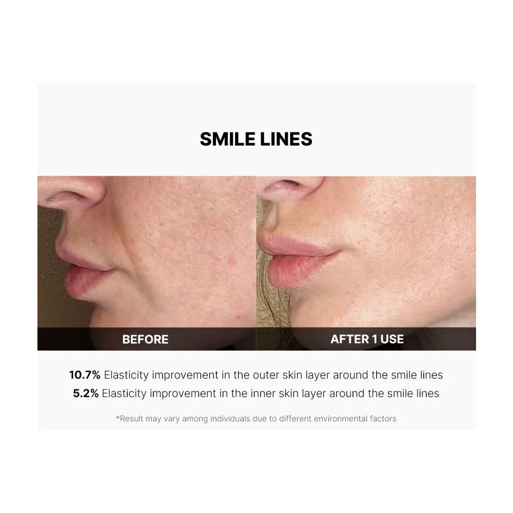 AGE-R Derma EMS Shot