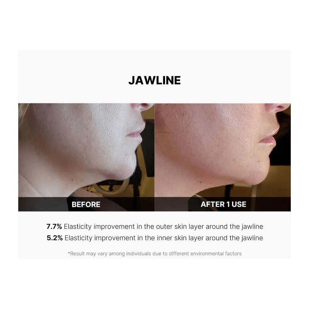 AGE-R Derma EMS Shot