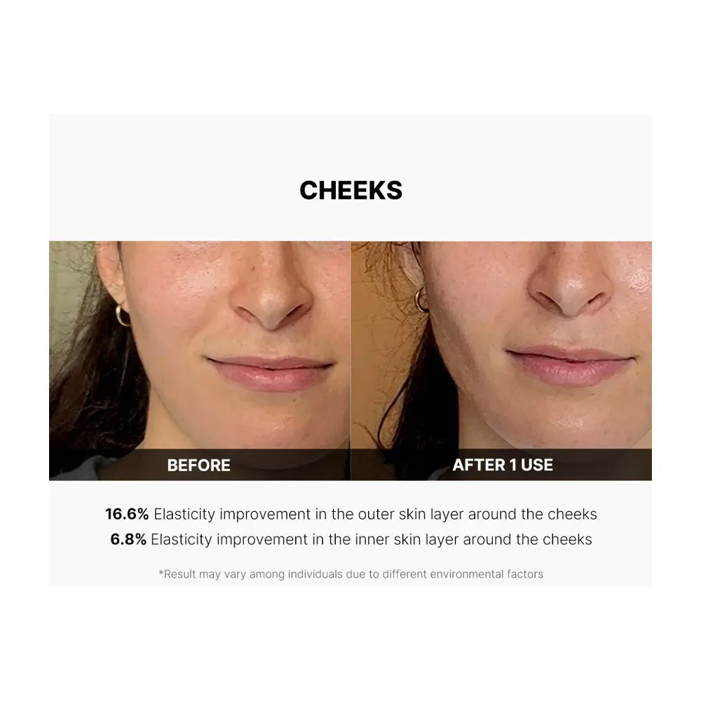 AGE-R Derma EMS Shot
